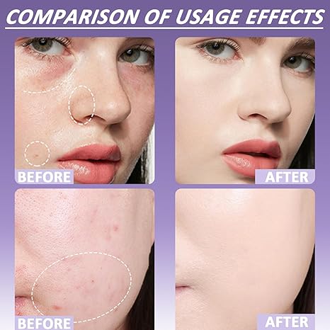 đ„ SISTA DAGEN 49%OFFđ„Soft Matte Cream Concealer