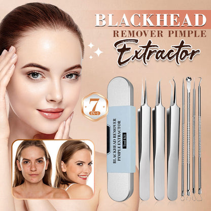 🎈 2026 Sale — Over 37,000 Sold! 🧴 Medical Grade Blackhead Extraction Tool Kit