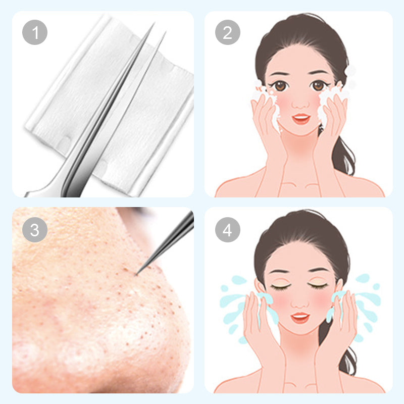 🎈 2026 Sale — Over 37,000 Sold! 🧴 Medical Grade Blackhead Extraction Tool Kit