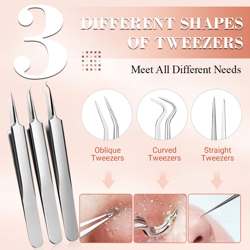 🎈 2026 Sale — Over 37,000 Sold! 🧴 Medical Grade Blackhead Extraction Tool Kit